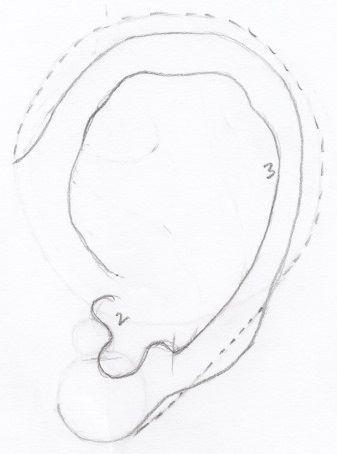 Inner helix added to Ear oulines